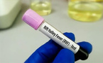Mpox et Fièvre de la Vallée du Rift : Thiès enregistre son premier cas , 302 cas confirmés au Sénégal