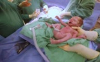 Une mère attendait des jumeaux normaux, mais lorsque les médecins lui ont montré cette photo, elle a eu le souffle coupé.