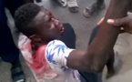 Vidéo - Vol à l'arrachée : Des agresseurs s'en prennent à deux dames avant de se voir lynchés par les passants