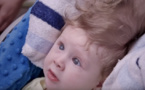 Un bébé nait avec le cerveau au-dessus du crâne