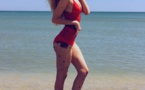 Une Ukrainienne avec une anomalie génétique devient une star d’Instagram