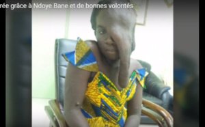 Témoignage émouvant de cette femme souffrant d’une maladie rare, finalement opérée. Ecoutez !