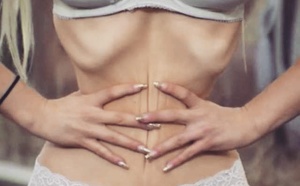 Une Américaine se fait retirer 6 côtes pour avoir un physique "parfait"
