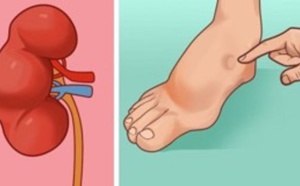 Un mois avant de faire un Avc, votre corps peut vous envoyer ces signes d’avertissement. Ne les ignorez pas!