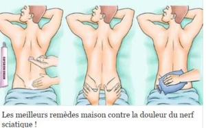 Les meilleurs remèdes maison contre la douleur du nerf sciatique !