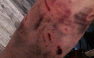 Taser et morsures de chiens : à la frontière hongroise, la haine anti-migrants