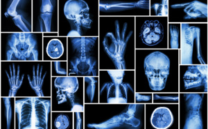 le 8 novembre, Journée internationale de la radiologie