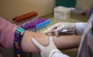 Drépanocytose: des chercheurs africains essaient un dépistage ultra-rapide et moins coûteux