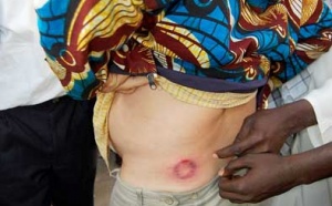 SÉVÈRE REPRESSION POLICIÈRE CONTRE LES JEUNES DE REBEUSS ET MÉDINA : 7 personnes arrêtées, Khalifa Sall malmené, Aly Aïdar reçoit une balle en caoutchouc