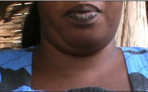 Enquête: l'inquiétante "drogue sexuelle" qui séduit des Sénégalaises (Réalisée par le site "Les observateurs" de France 24)