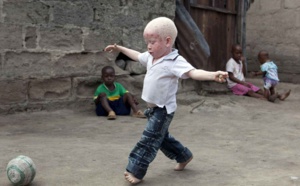 Élection législative de juillet prochain: La grande peur des albinos