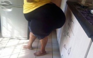 Une femme se dit « maudite » à cause de ses grosses fesses