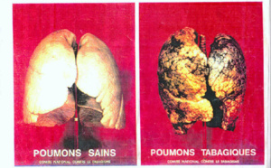Sénégal : de nouveaux paquets de cigarettes avec des avertissements contre le tabagisme