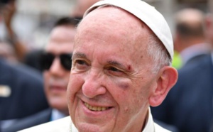 Le pape se blesse légèrement au visage après un freinage brutal de sa papamobile