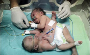 MÉDECINE: Les deux sœurs doivent quitter Gaza pour survivre