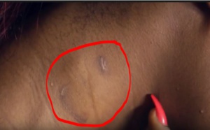 Vidéo:  Incroyable - Betty montre ses blessures infligées par Eva