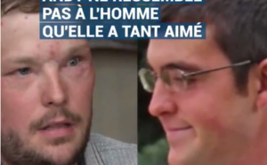 Le visage de son mari décédé a été transplanté sur cet homme, aujourd'hui elle le touche et fond en larmes.