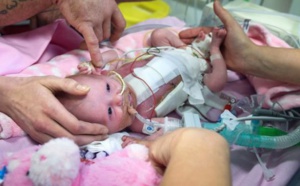 Royaume-Uni: un bébé né avec le cœur hors de la poitrine, survit miraculeusement