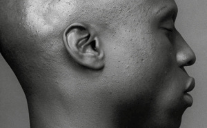 La dépigmentation volontaire de la peau concerne aussi les hommes