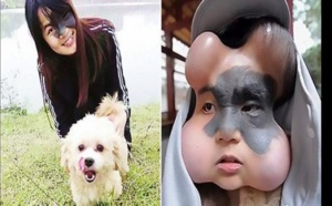 Chine: 4 ballons implantés dans le visage d’une femme pour sauver sa vie
