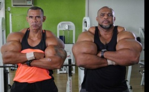 Brésil: ils s’injectent des produits chimiques pour gonfler leurs biceps (Photos)