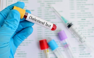 Le Cholestérol - Ce que vous pouvez faire pour abaisser votre taux.