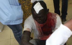 Photos : Cet homme serait celui qu'on a annoncé comme mort, mais, il aurait reçu juste un caillou