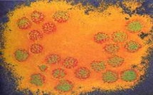 CANCER DU COL DE L’UTÉRUS : Un programme de dépistage démarre à Thiès
