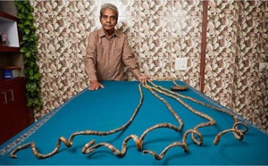 L'homme aux ongles les plus longs du monde a fini par les couper (vidéo)