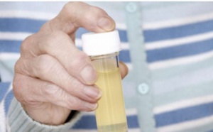 Infection urinaire: causes et symptômes