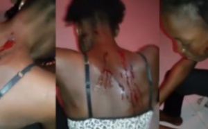 Femme battue à Touba:  Intimidations et pressions pour étouffer l’affaire (Audio)