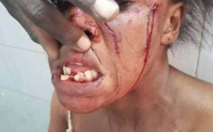 Touba : Une dame charcute et édente sa co-épouse