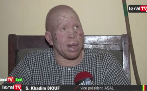 VIDEO - Présidentielle 2019 : Les albinos de Touba craignent pour leur sécurité et interpellent l'Etat