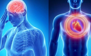 Infarctus, AVC : les symptômes qui doivent vous alerter