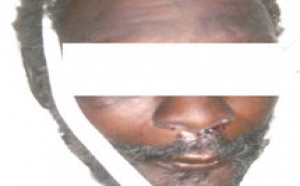 HÔPITAL PRINCIPAL DE DAKAR - Avis de reconnaissance de corps : Ces vies perdues et enterrées dans l’anonymat