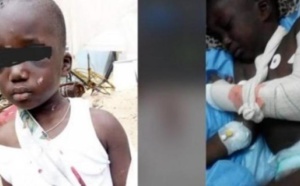 Affaire de l’enfant "torturé" à Mbour: La belle-mère relaxée !