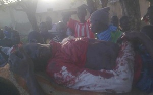 Mort de Mamadou Ndiaye : l’autopsie révèle qu’une balle réelle de 1,5 cm X1 a eu raison de l’étudiant