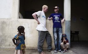La grande peur des albinos