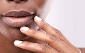 Avec l'harmattan, essayez cette astuce pour ne plus avoir les lèvres gercées