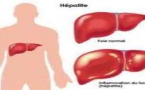 Traitement des hépatites virales : Essayez le Terminalia catappa, le Tinospora, le Tamarindus…