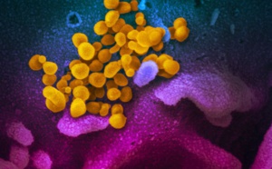 AUDIO - Coronavirus: Un Sénégalais atteint par le coronavirus explique les symptômes