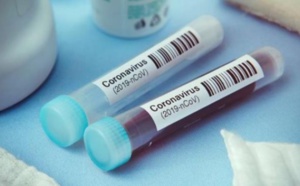 CORONAVIRUS: 66 CONTACTS DONT 14 CAS À HAUT RISQUE, RECENSÉS À RICHARD-TOLL