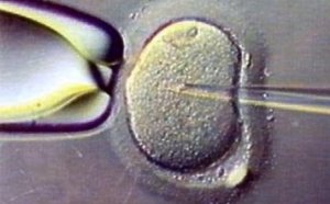 Santé : 5 millions de bébés nés par fécondation in vitro depuis 1978
