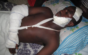 Fauché par le cortège de Macky Sall à Ziguinchor Un jeune homme lutte contre la mort
