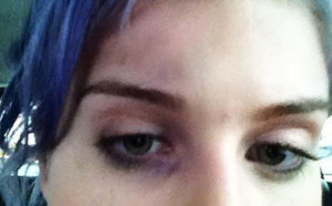 Photo : Kelly Osbourne et son oeil au beurre noir