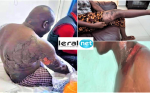 VIDEO - Kawtef à Touba: Une femme  ébouillante son mari - LERAL TV