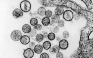 Alerte à l'hantavirus en Californie