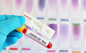 Montée fulgurante des cas de Covid au Sénégal: Des experts de l’Oms accusent l’Etat