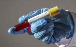 Covid -19 / Ravages à la BCEAO: Mort d'un cadre, un autre en réanimation et des cas contacts