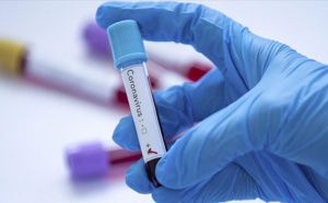 Covid -19 / Tests payants: Non, il n'y a pas de "baana-baana" chez les médecins !